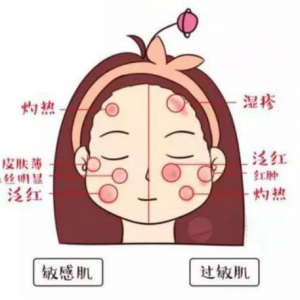 一到换季就脸上发红过敏？一招解决敏感肌肤